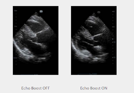 Cardiology DC-8 Exp Ultrasound Machine Suppliers in India