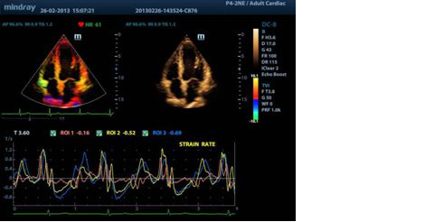 DC-8 Ultrasound Machine Suppliers India