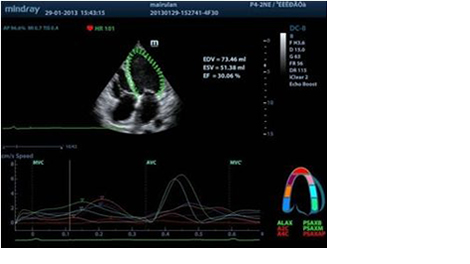 Tissue Tracking with Quantitative Analysis
