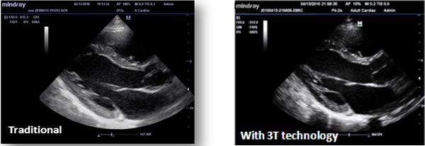 M7 Premium Ultrasound System India