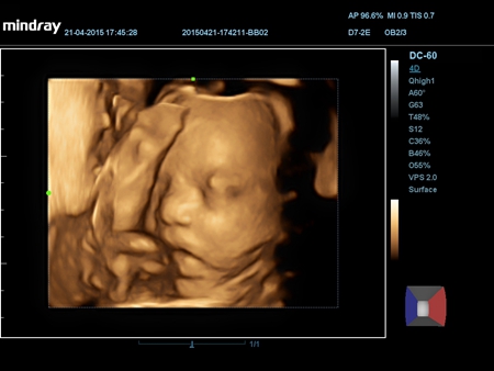 4D Imaging