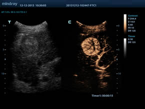 UWN+ Contrast Imaging