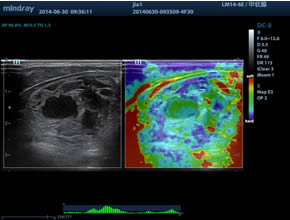 Natural Touch Elastography