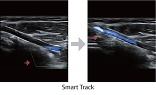 Smart Track