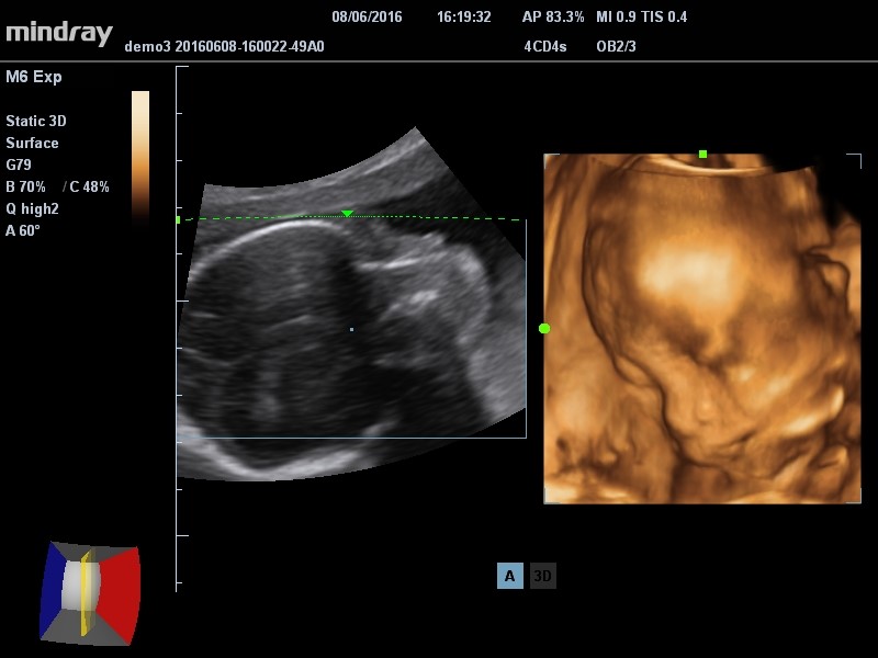 3D/4D Imaging