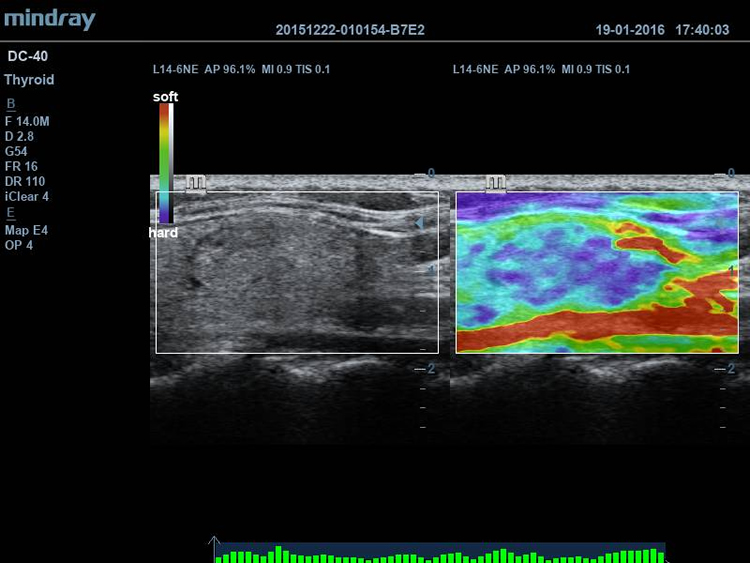 Natural Touch Elastography
