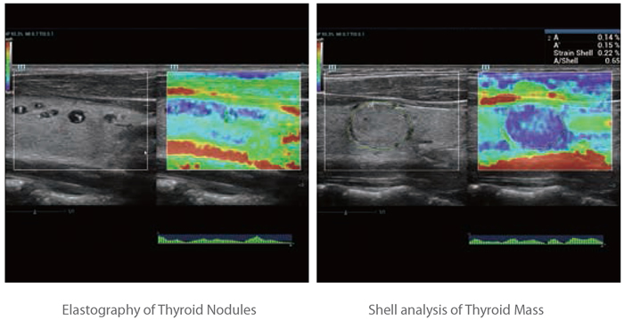 Natural Touch Elastography