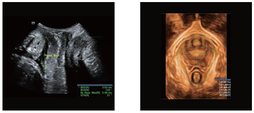 Smart Pelvic