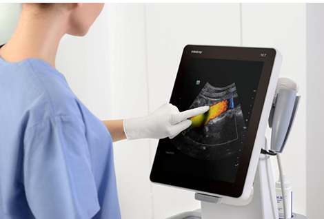 TE7 Ultrasound System India