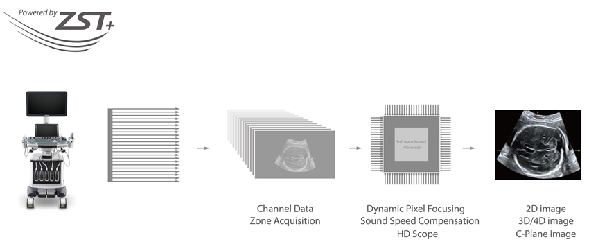 Resona 6 Ultrasound System