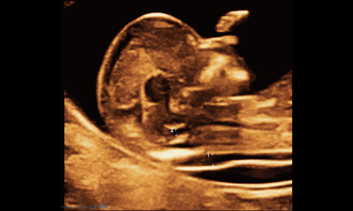 Smart OB/NT