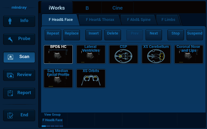iWorks