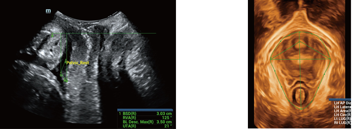 Smart Pelvic