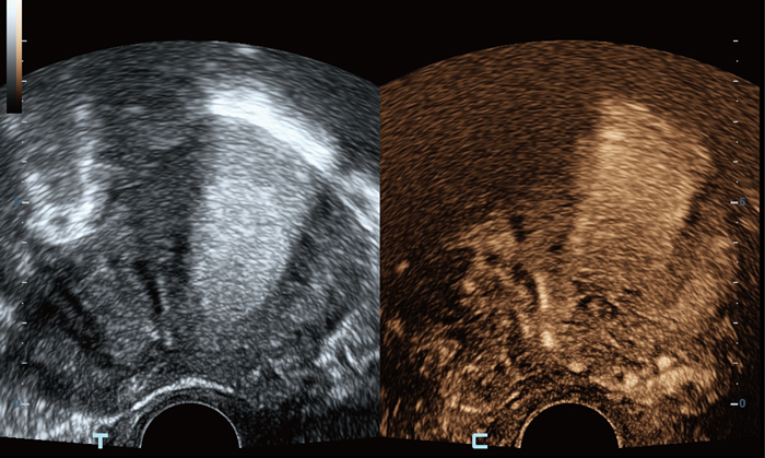 UWN+ Contrast Imaging