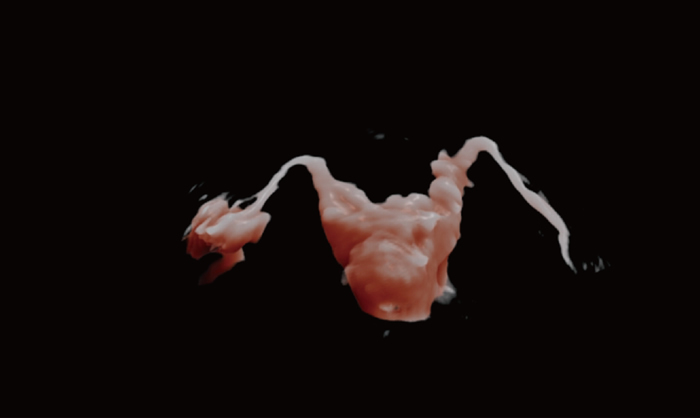 3D/4D Hycosy（HysterosalpingoContrast Sonography）