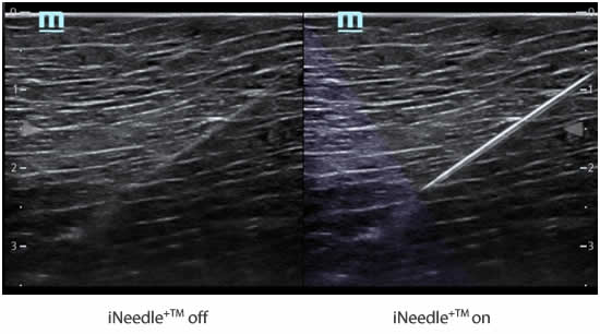TE5 Ultrasound System Suppliers