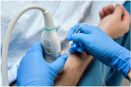 TE5 Ultrasound System Suppliers